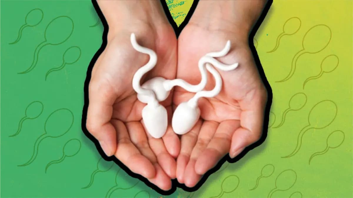Oligospermi (sperm azlığı) — avuç içinde iki sperm modeli